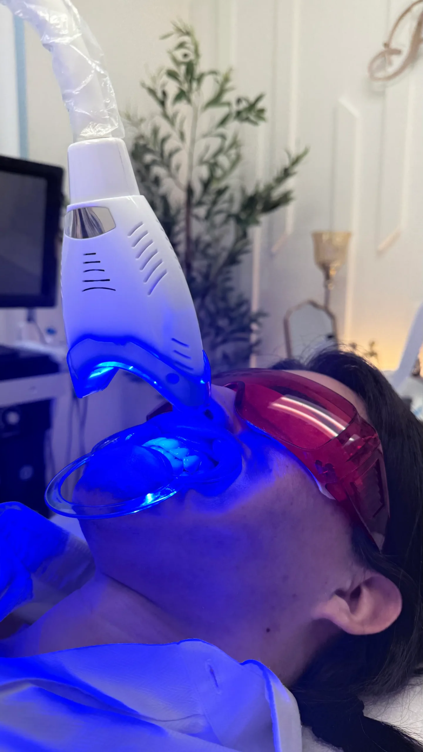 Blanqueamiento dental